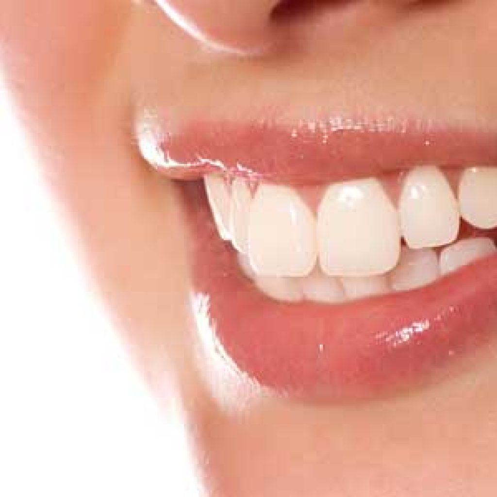 The truth about Teeth Whitening.