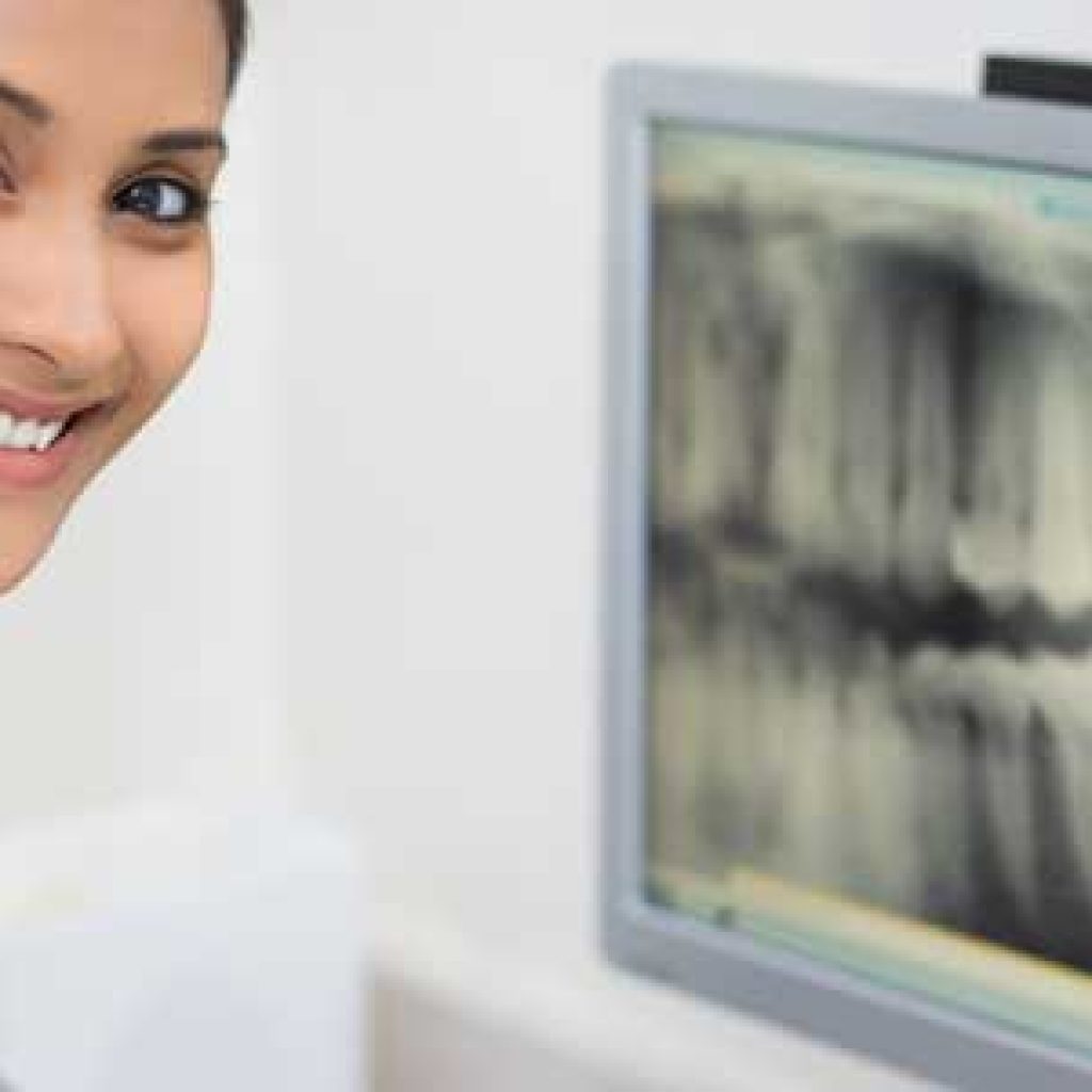 Dental X-rays explained.